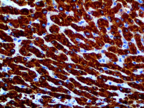 IHC of iNOS on an FFPE Liver Tissue